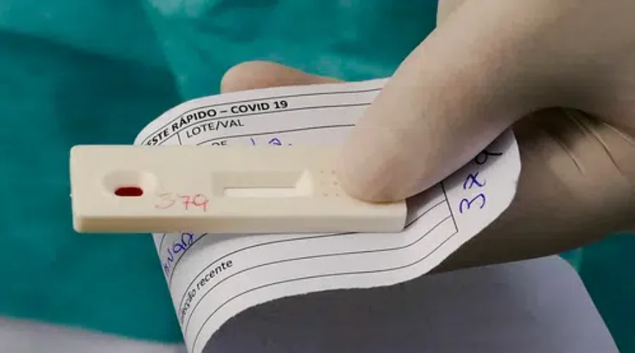 Incidents Of COVID-19 Still Low