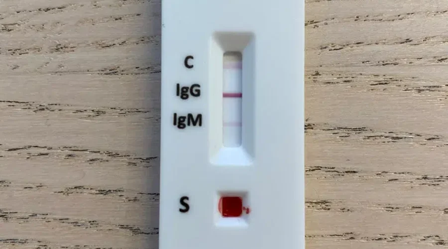 Cases Up, but Test Rate Continues to Fall